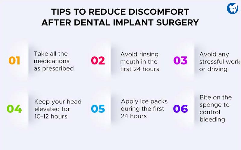 Tips to avoid discomfort after dental implant surgery